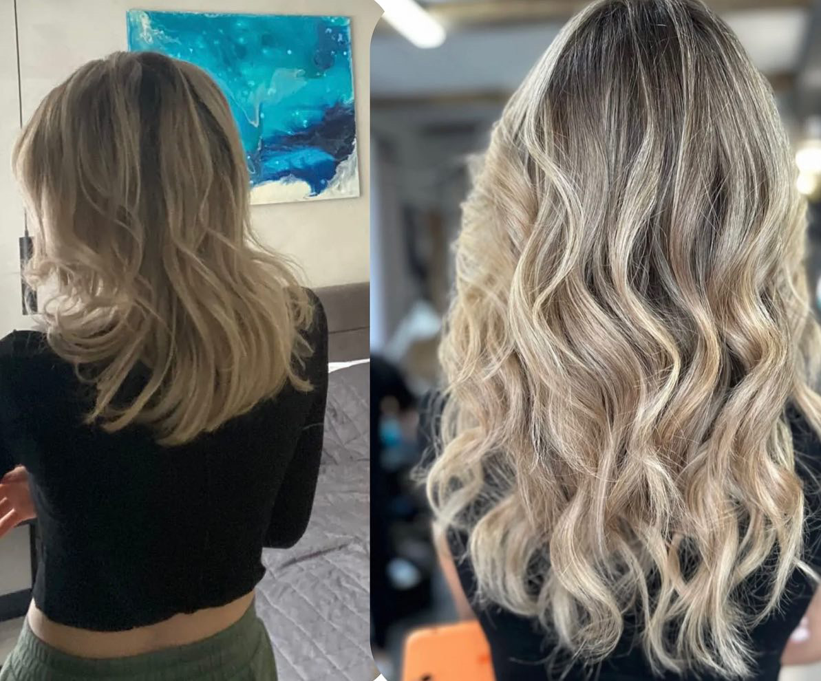 До і після лікування