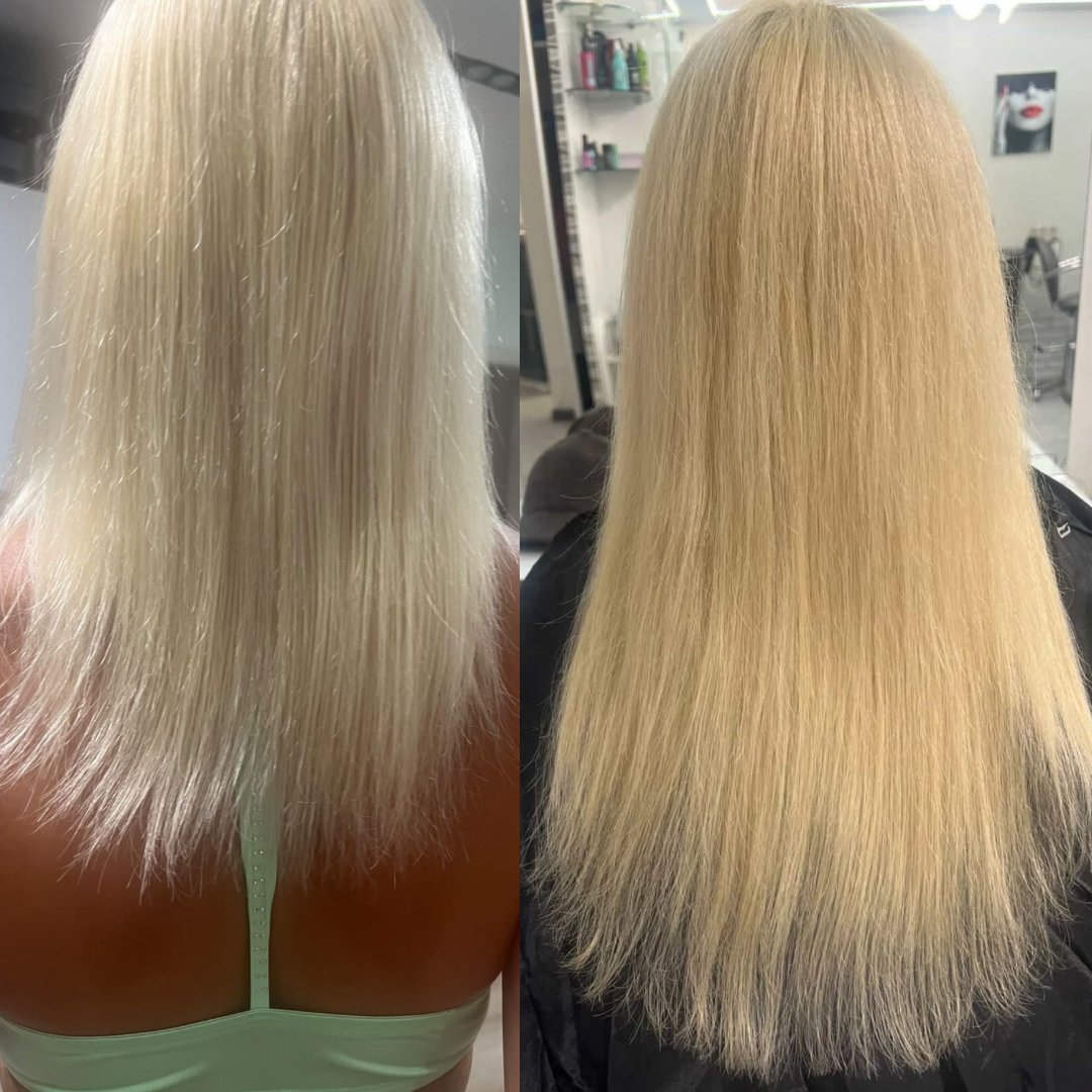 До і після лікування